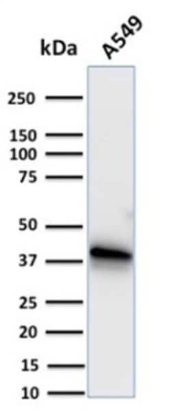 Annexin A1 Antibody (CPTC-ANXA1-1) - Azide and BSA Free, Novus Biologicals